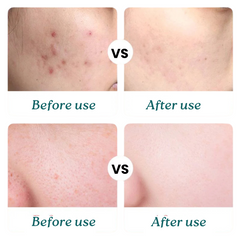 Glow Bright Brightening Cream (Korean Skincare)